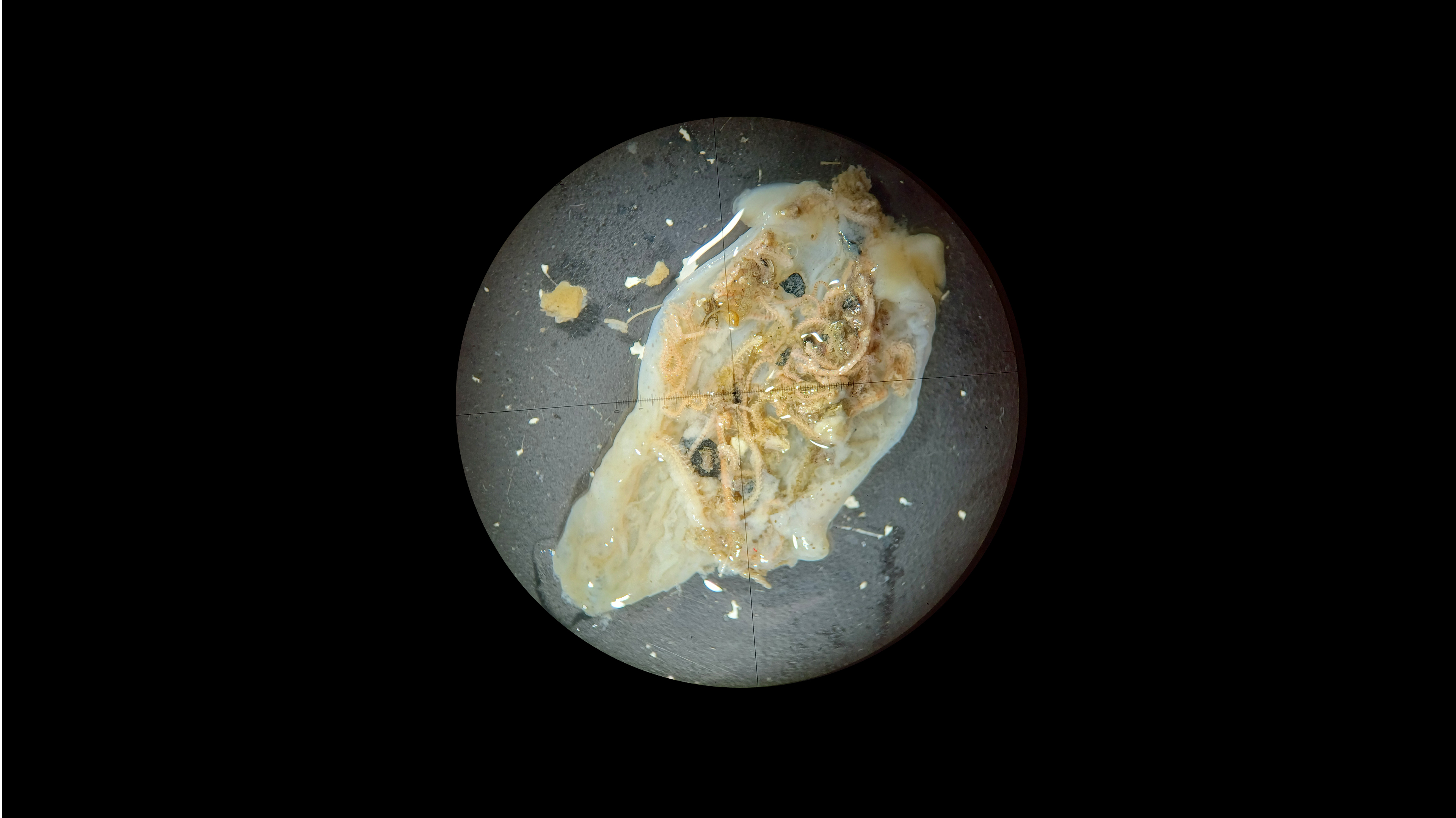 Photo of a fish stomach content containing many brittlestars